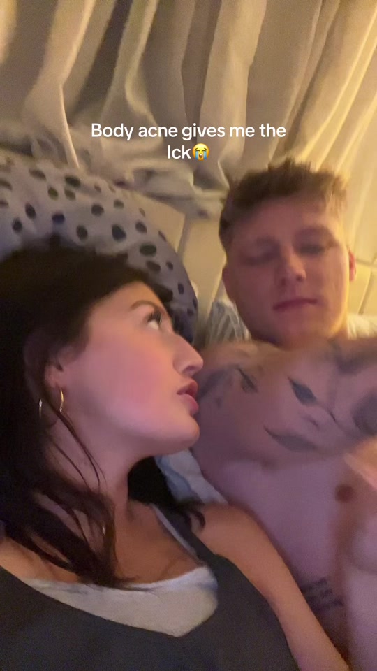 Couple's Testimonial for Body Acne Product by jamiefinds3